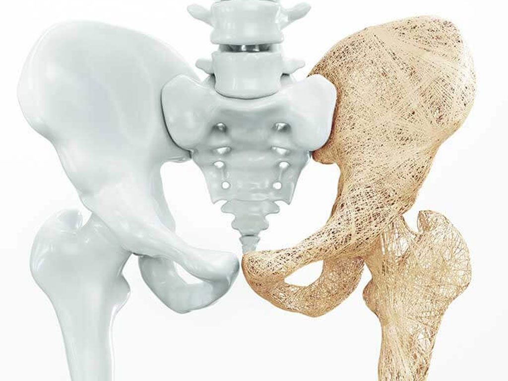 نصائح للوقاية من هشاشة العظام