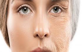 علاج التجاعيد